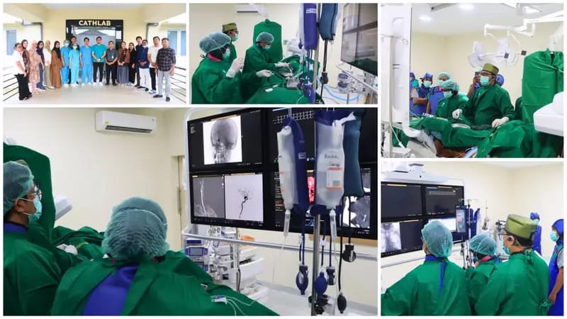 RS Adam Malik Dampingi Operasi Coiling Aneurisma Pertama di RSUD Deli Serdang